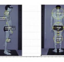 Software gratuito auxilia na avaliação postural